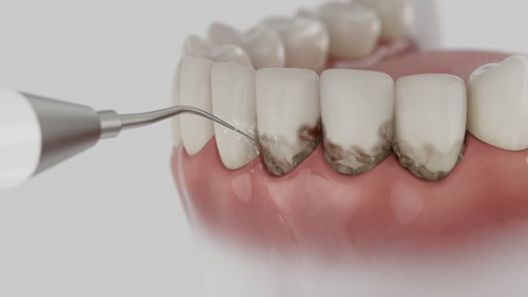 Reliable Dental Implants contractor in Farrell, PA by Smile Center Dentistry